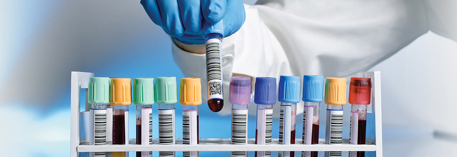 Samples in laboratory tubes